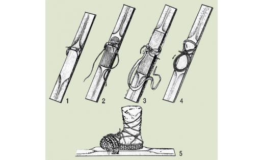 Способы крепления лыж к ноге: 1 - с петлёй; 2 - с петлёй и боковыми бечёвками; 3 - с двумя петлями; 4, 5 - с палочкой